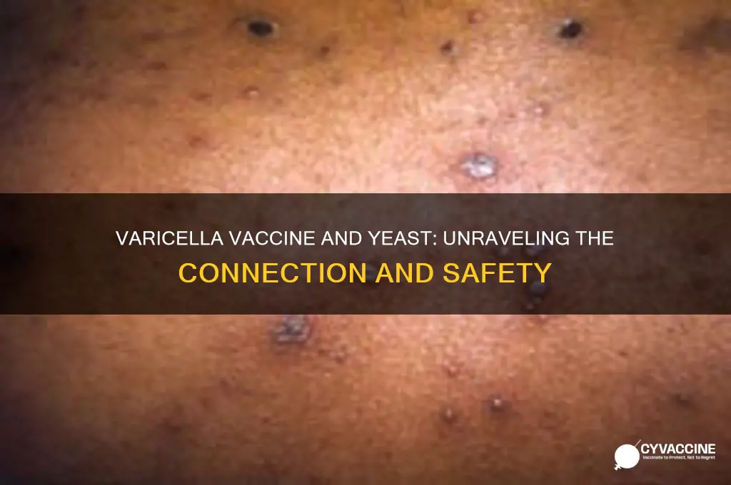 is there a varicella vaccine based on yeast