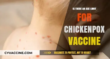 Chickenpox Vaccine: Age Restrictions and Eligibility Explained