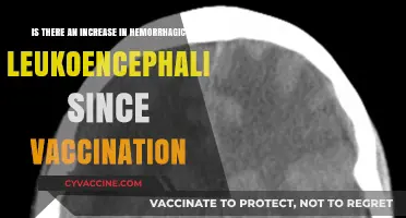 Hemorrhagic Leukoencephalitis Cases: Post-Vaccination Trends and Concerns Explored