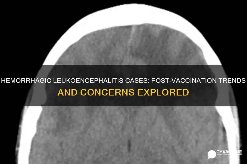 is there an increase in hemorrhagic leukoencephalitis since vaccination