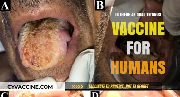 Exploring the Possibility of an Oral Tetanus Vaccine for Humans