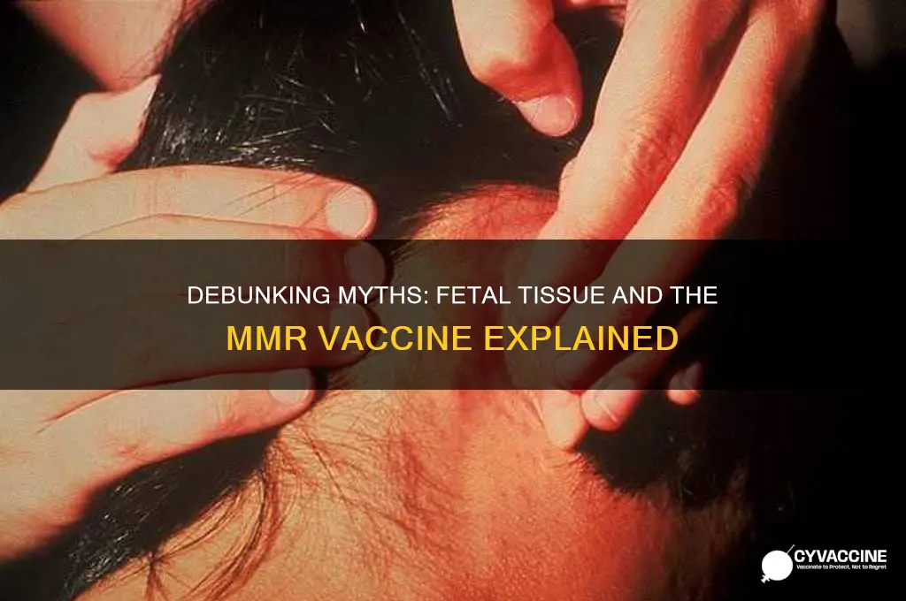 is there fetal tissue in the mmr vaccine