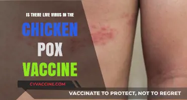 Does the Chickenpox Vaccine Contain Live Virus? Facts Explained