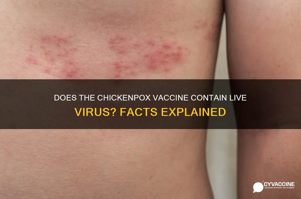 is there live virus in the chicken pox vaccine