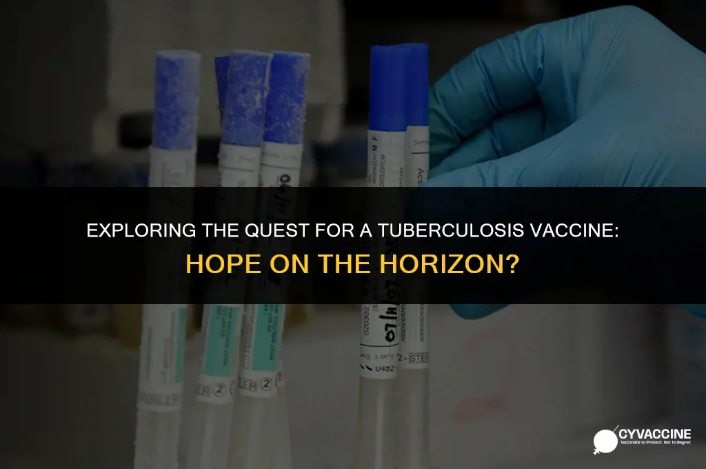 is there s vaccine for tb