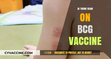 Understanding BCG Vaccine Scars: Facts, Myths, and Aftercare