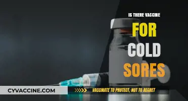 Exploring the Quest for a Cold Sore Vaccine: Facts and Myths