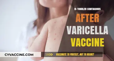 Toddler Contagiousness Post-Varicella Vaccine: What Parents Need to Know