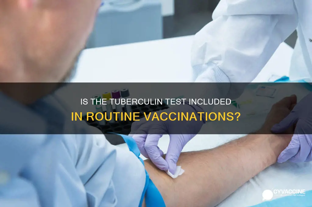 is tuberculin test part of a regular vaccination