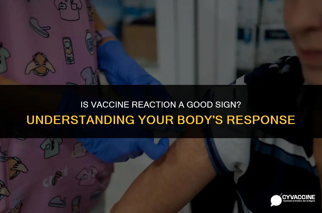 is vaccine reaction a good sign