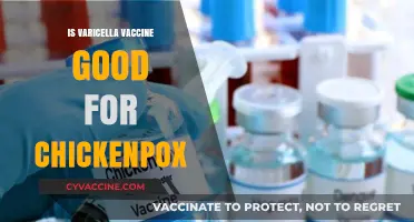 Varicella Vaccine: Effective Protection Against Chickenpox