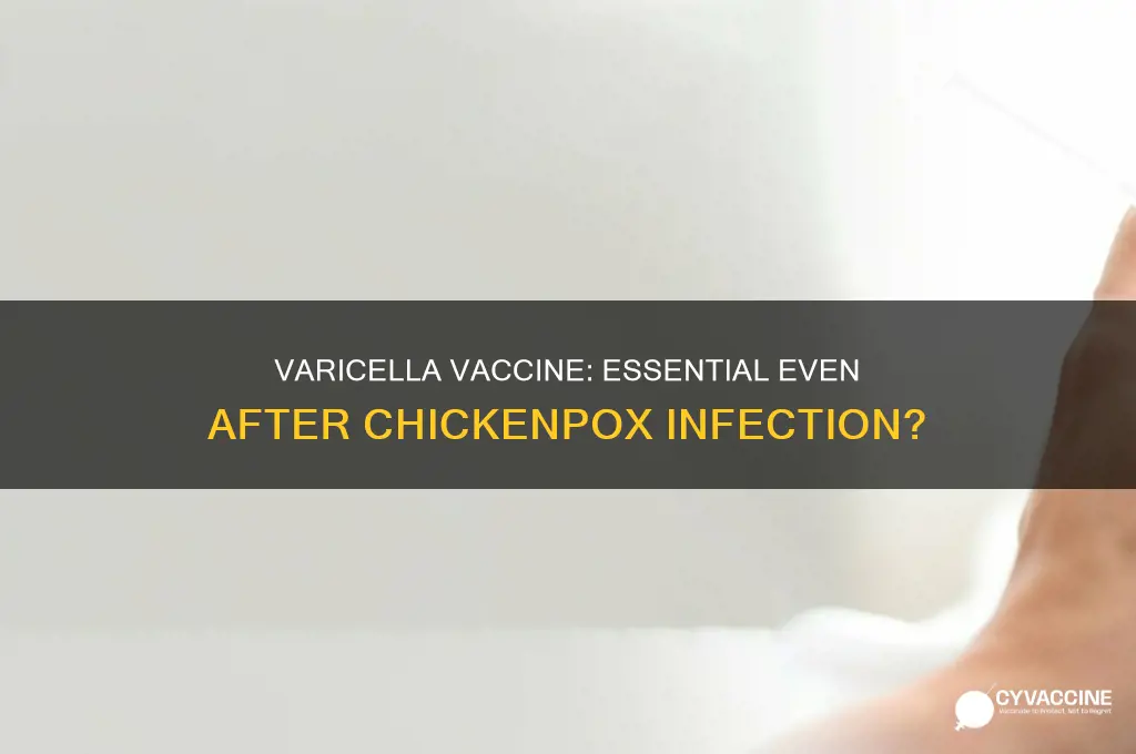 is varicella vaccine necessary if already had chickenpox