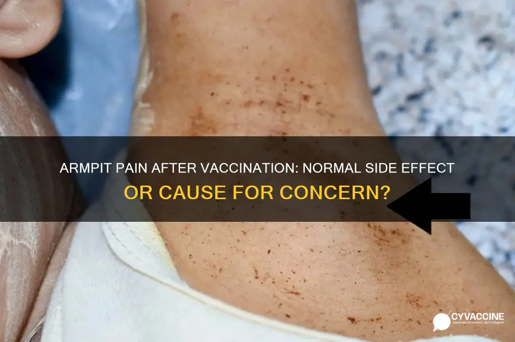 is your armpit supposed to hurt after a vaccine