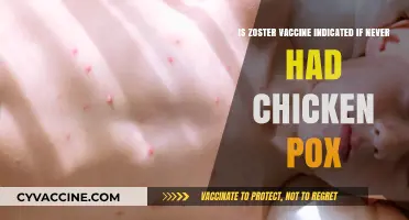 Should You Get the Shingles Vaccine Without a Chickenpox History?