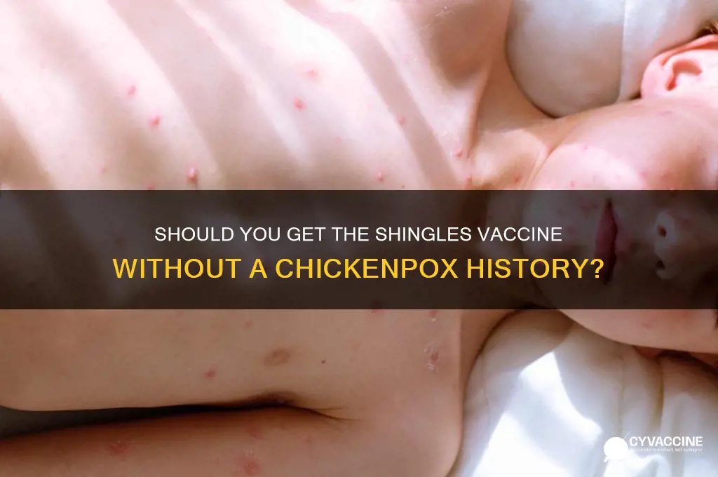 is zoster vaccine indicated if never had chicken pox