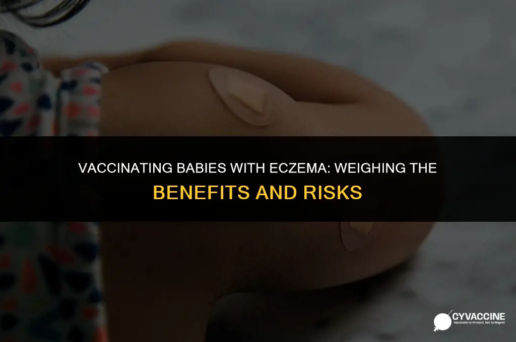 should babies with eczema be vaccinated