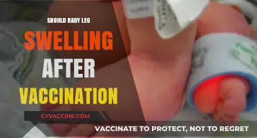 Understanding Baby Leg Swelling Post-Vaccination: Causes and Care Tips