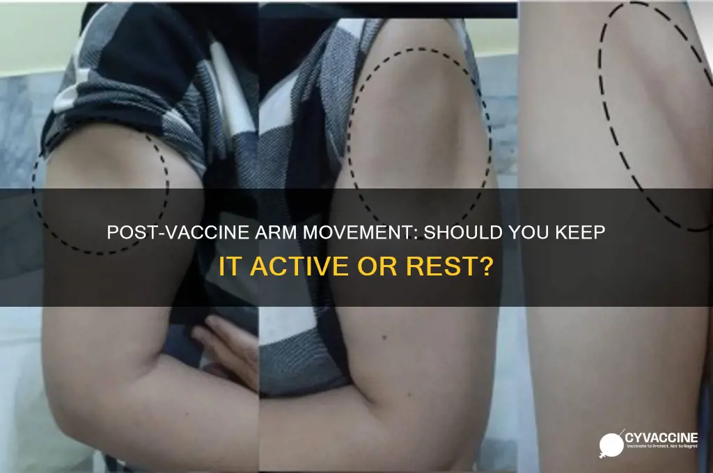 should i keep my arm moving after vaccine