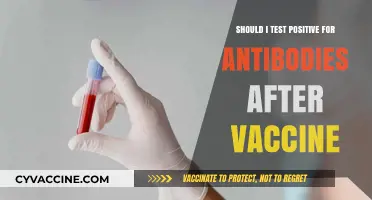 Post-Vaccine Antibody Testing: Should You Expect a Positive Result?
