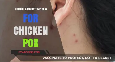 Should You Vaccinate Your Baby Against Chicken Pox? Pros and Cons