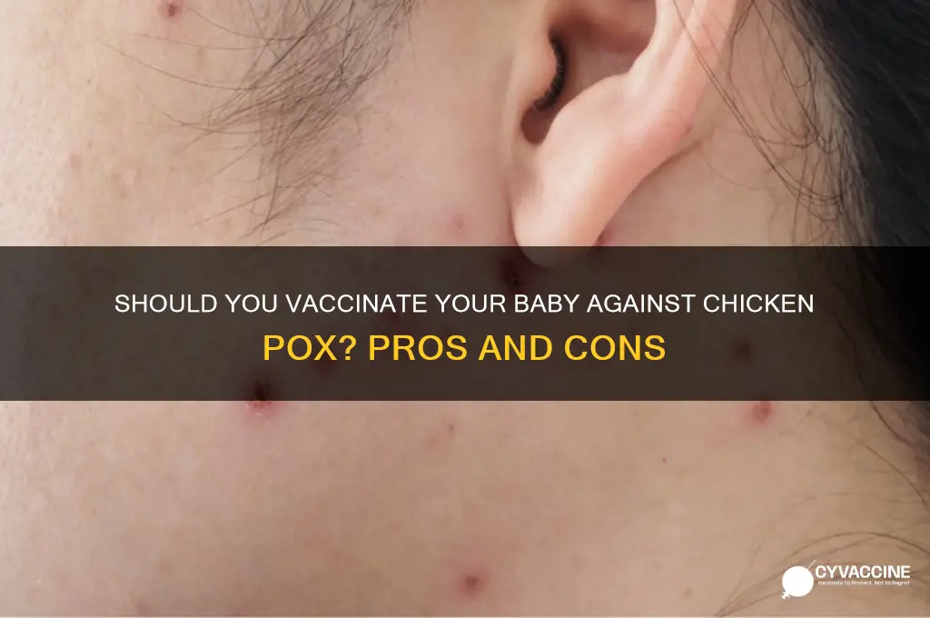 should i vaccinate my baby for chicken pox