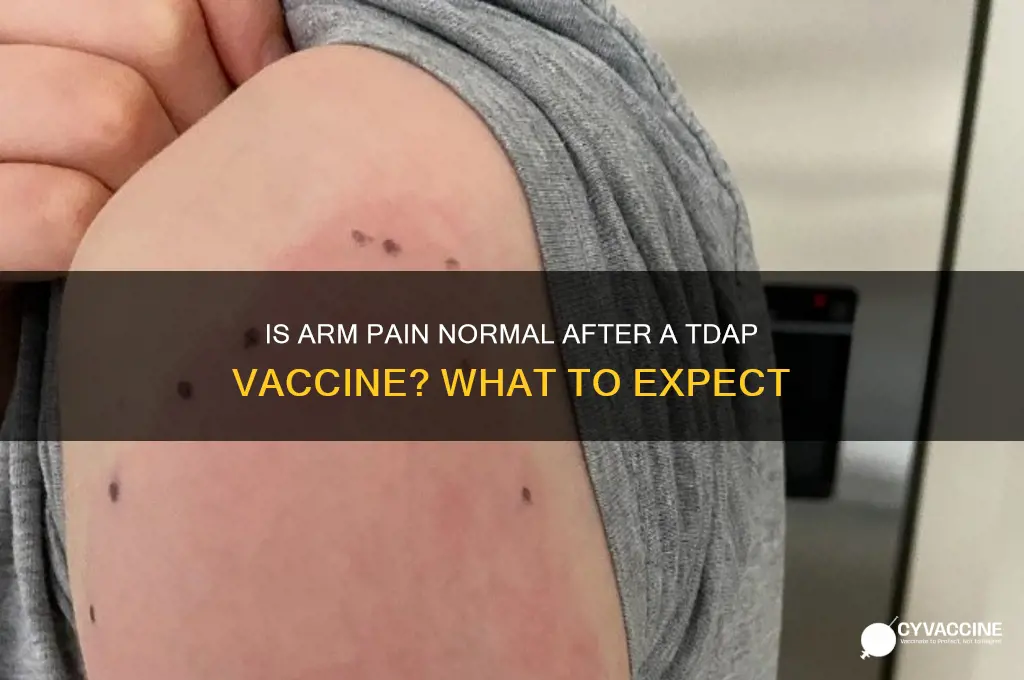 should my arm hurt from a tdap vaccine