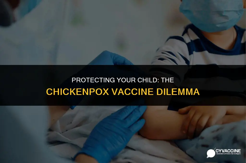 should my child have chickenpox vaccine