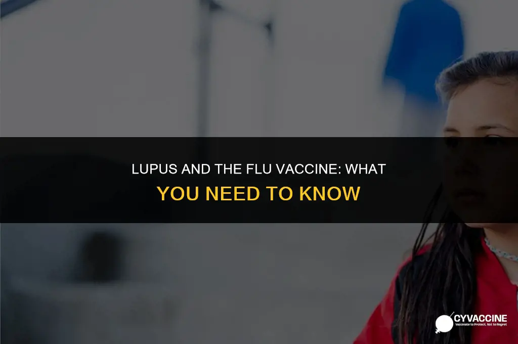 should systemic lupus avoid influenza vaccine