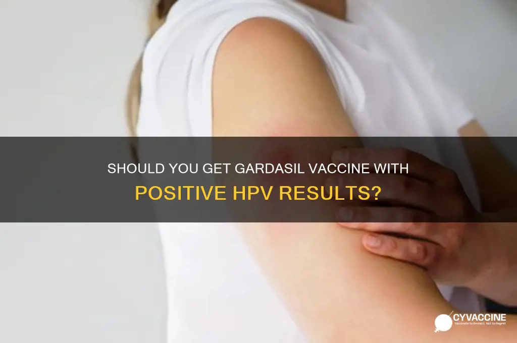 should you have guardasil vaccine even if positivie pap