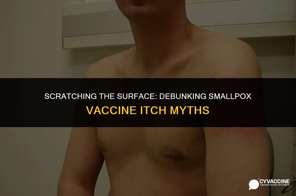 should you itch the smallpox vaccine