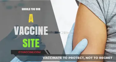Should You Rub a Vaccine Site: Expert Advice and Guidelines