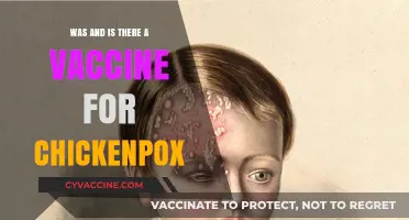 Chickenpox Vaccine: Past, Present, and Its Impact on Health