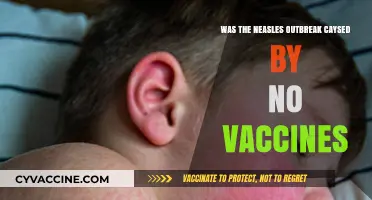 Unvaccinated Communities: The Root Cause of Recent Measles Outbreaks?