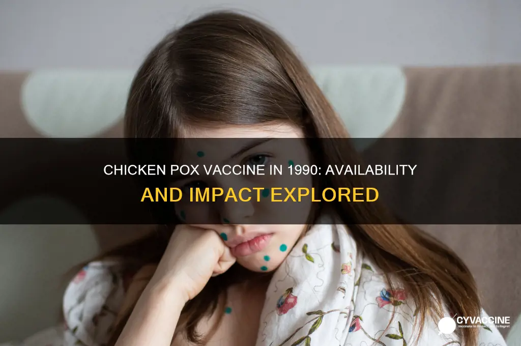 was there a chicken pox vaccine in 1990