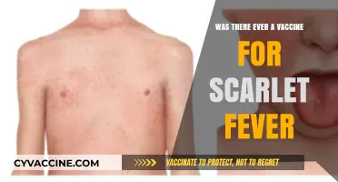 Scarlet Fever Vaccine: Historical Facts and Modern Prevention Methods