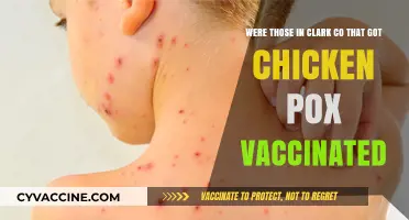 Clark County Chickenpox Outbreak: Were Vaccinated Individuals Affected?