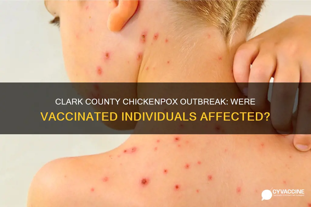 were those in clark co that got chicken pox vaccinated