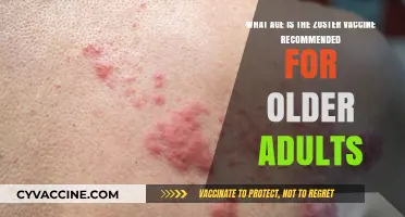 Recommended Age for Zoster Vaccine in Older Adults Explained