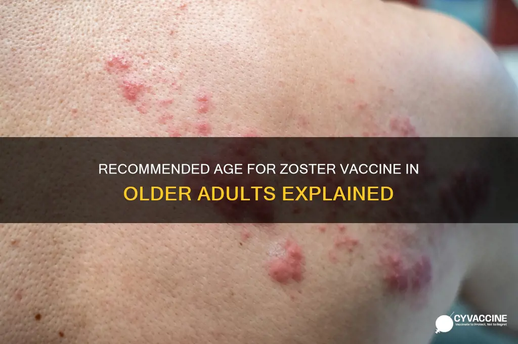 what age is the zoster vaccine recommended for older adults