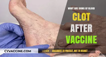Recognizing Blood Clot Symptoms Post-Vaccination: What to Watch For
