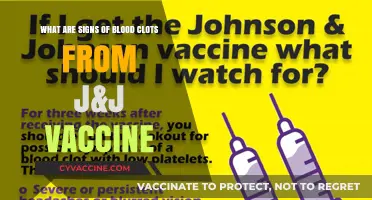 Recognizing Blood Clot Symptoms Linked to the J&J Vaccine