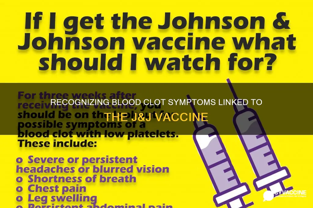 what are signs of blood clots from j&j vaccine