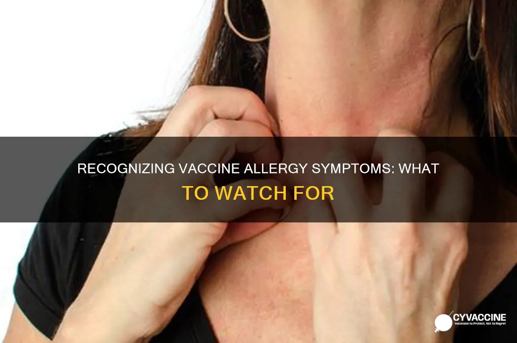 what are symptoms of allergic reaction to vaccine