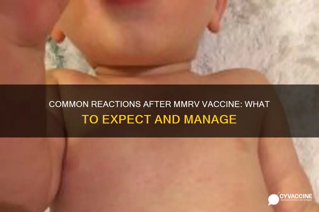 what are the common reaction after mmrv vaccine
