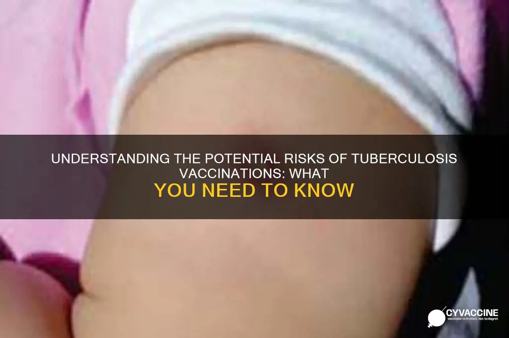 what are the risks of vaccinations for tuberculosis