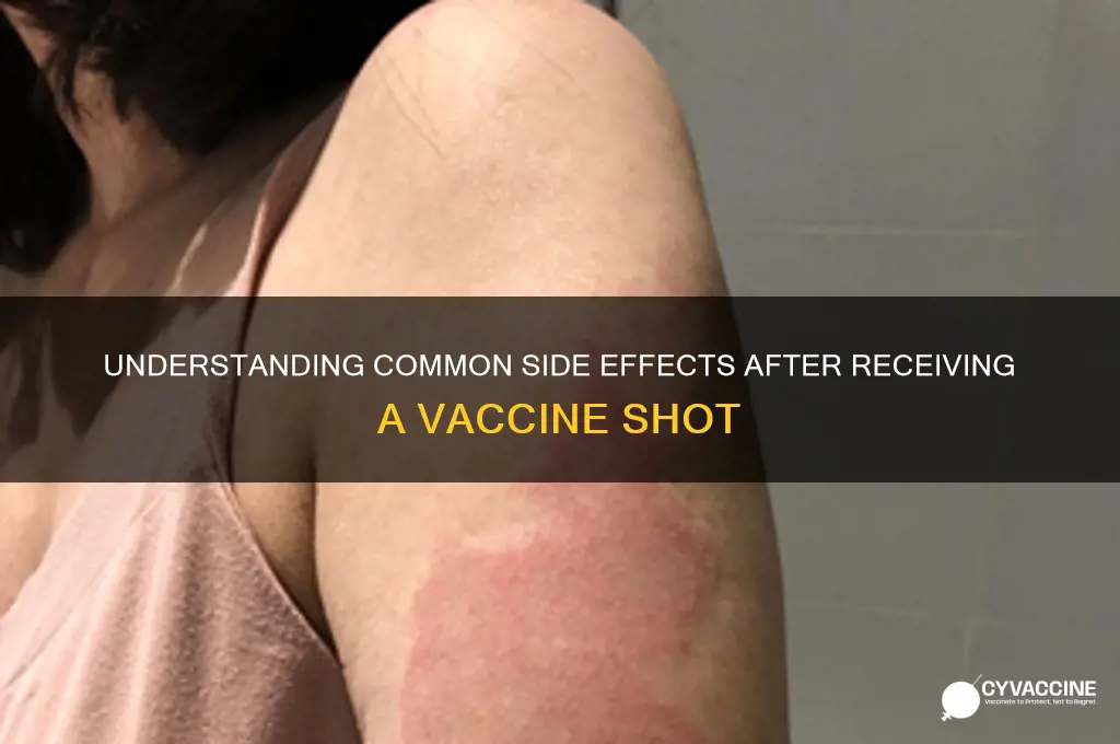 what are the symptoms of the vaccine shot
