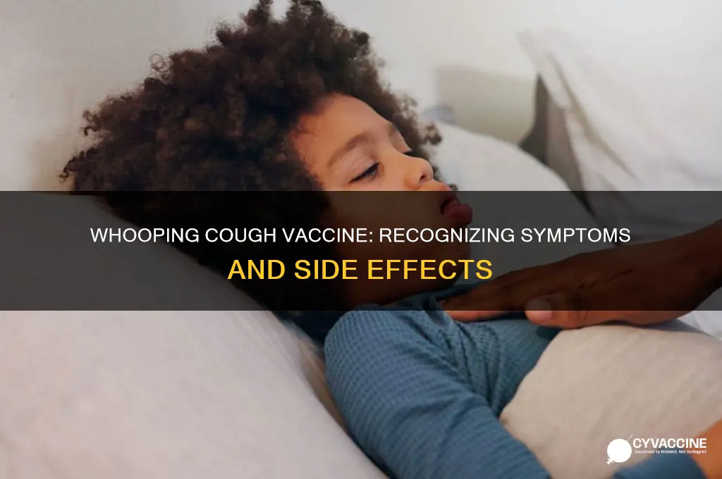 what are the symptoms of whooping cough vaccine