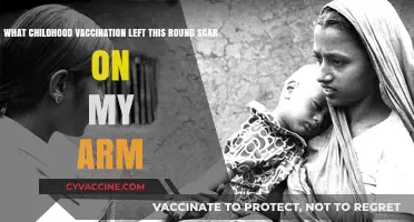 Unveiling the Mystery: The Round Scar from My Childhood Vaccination