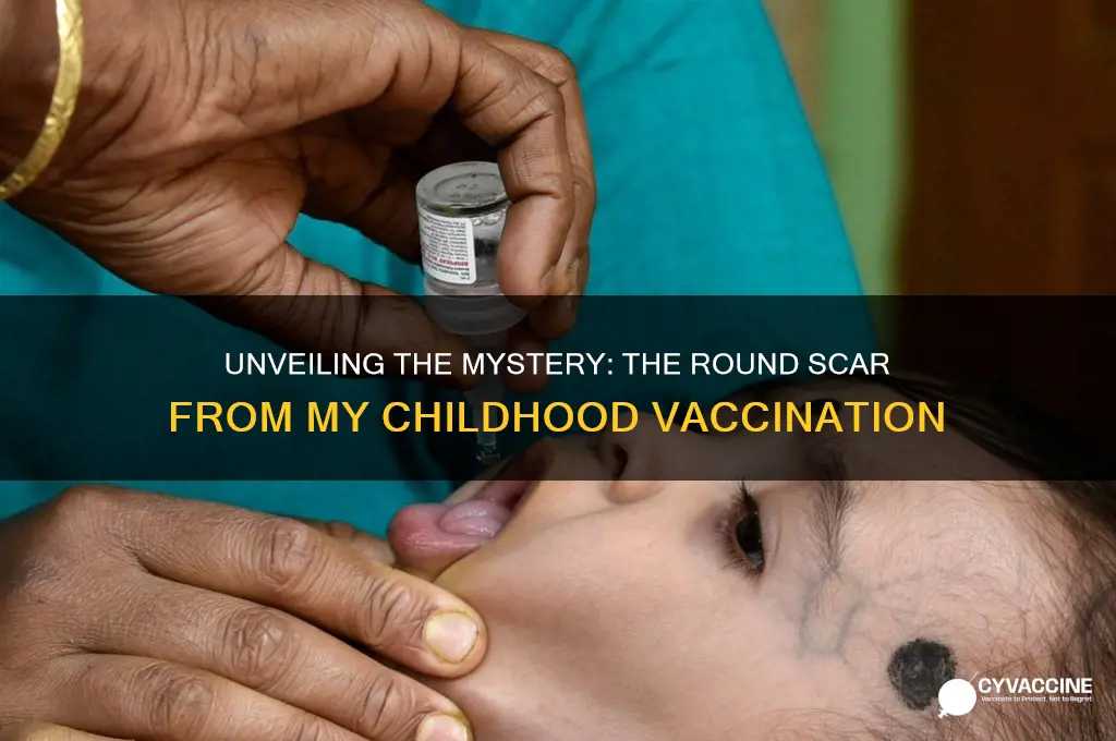 what childhood vaccination left this round scar on my arm