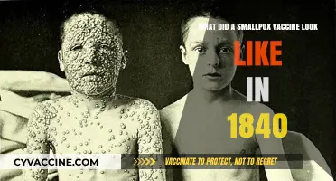 Unveiling the 1840 Smallpox Vaccine: A Historical Visual Journey